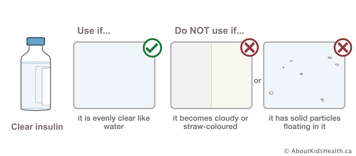 Illustration of evenly clear insulin, cloudy or straw-coloured insulin, and insulin with solid particles floating in it