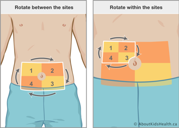 Rotating clockwise between four sites on the lower abdomen, and rotating clockwise within each of those sites