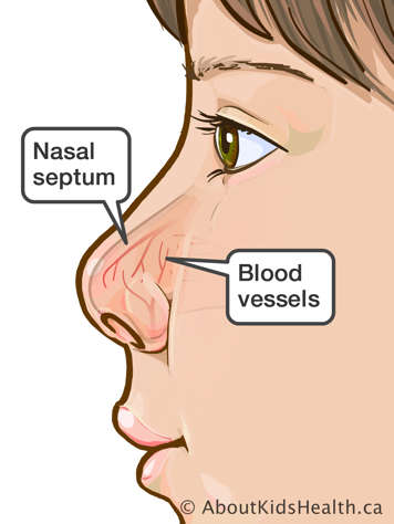 Identification of nasal septum and blood vessels in a child’s nose