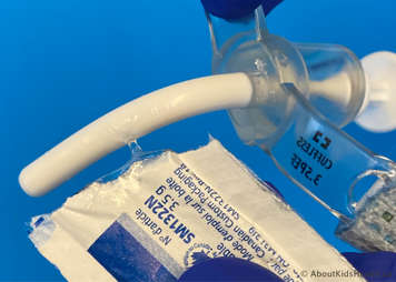 Lubricating the tracheostomy tube using a water-soluble lubricant