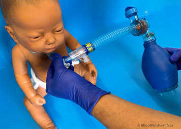 LVR bag is attached to the tracheostomy using the tracheostomy adaptor, the bag is not being squeezed