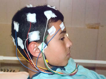 Child with electrodes attached to scalp and forehead