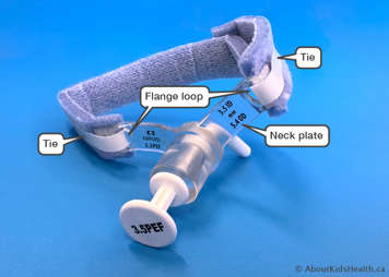 tracheostomy tube with tie, showing the neck plate and flange loop