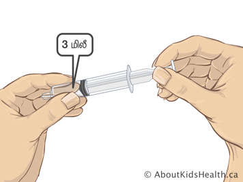 Two millilitres of liquid in a syringe attached to an NG tube