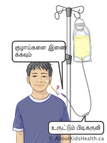 Connect tubes and roller clamp on infusion tubing for attaching a feeding bag to a child&rsquo;s NG tube