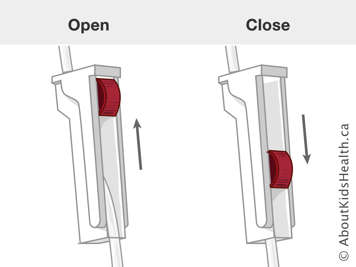 An open clamp and a closed clamp on infusion tubing