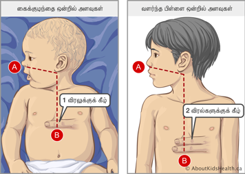 ஒரு சிசு மற்றும் ஒரு வளர்ந்த பிள்ளையின் நெஞ்சு எலும்பின் அடி மற்றும் தொப்புள் வரையான அளவீடுகள் மற்றும் அமைவிடம்