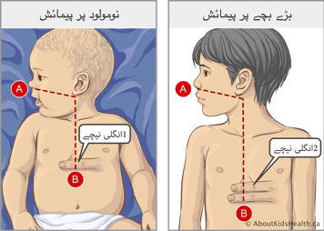 دودھ پیتے بچے اور ایک بڑے بچےکی پیمائشیں اور ان دونوں میں سینےکی نچلی ہڈی اور ناف کا مقام 