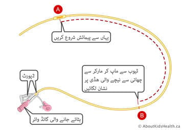 این جی ٹیوب پر لگے ہوئے پیمائشی نشانات دو پورٹس کے ساتھ اور اتاری جا سکنے والی گارڈڈ وائر