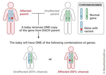 Baby receives genes from affected parent and unaffected parent resulting in 50% chance of having Noonan syndrome.