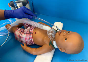 Suctioning a child’s mouth with a Yankauer catheter