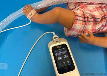 An oxygen saturation monitor on a child's foot providing an accurate reading