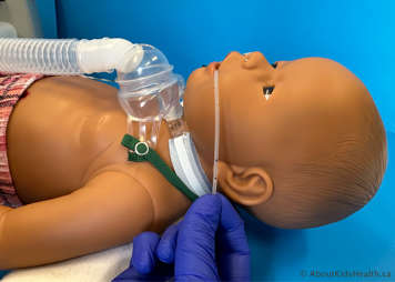 After removing the suction catheter from the packaging use it to measure the suctioning distance from the corner of the child's mouth to their earlobe