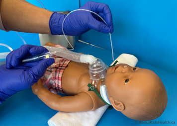 Suction catheter has completely been removed from the child's mouth while the thumb is still over the suction control port