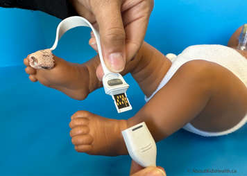 A probe wrapped around a child's toe showing the probe being attached to the cable