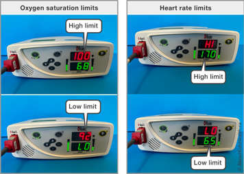 A Masimo Rad-8 Oximeter showing where on the screen the high and low oxygen saturation limits are and where the high and low heart rate limits are