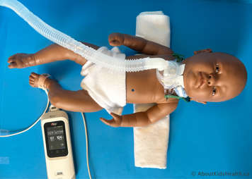 Child with a tracheostomy lying comfortably