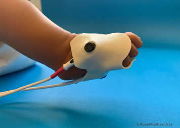 A probe wrapped around a child's foot