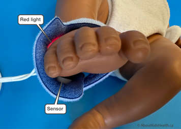 A close-up of a reusable Y-sensor probe with foam wrap on a baby's foot showing the placement of the red light and the sensor