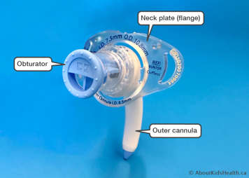 adult tracheostomy tube showing neck plate (flange), outer cannula and obturator