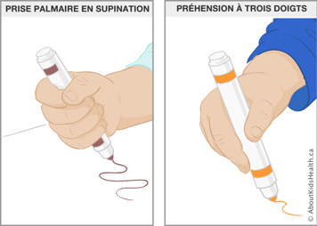 Illustration de la prise palmaire en supination et la préhension à trois doigts d’un marqueur