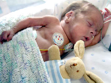 Preemie sleeping peacefully