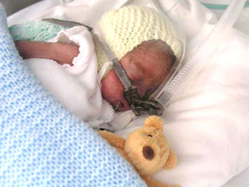 Preemie with CPAP