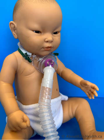 Child wearing a speaking valve with a humidified tracheostomy mask