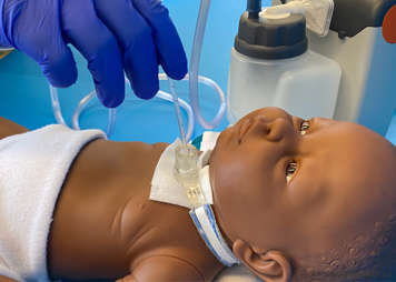 Suctioning a child’s tracheostomy tube