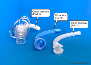 three-part tracheostomy tube showing outer cannula, obturator and inner cannula