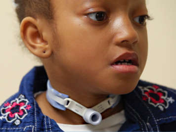 A child with a tracheostomy tube