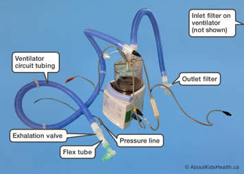 Parts of a wet passive ventilator circuit, as listed above