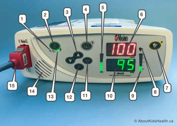 Numbered parts on an Masimo Rad-8 Oximeter