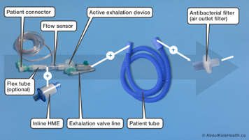 Parts of an active flow pediatric ventilator circuit as listed