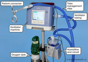 Parts of a ventilator setup