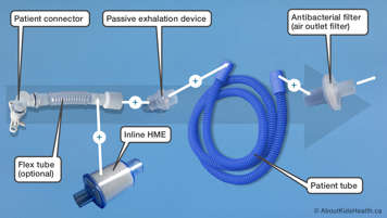 Parts of a passive pediatric ventilator circuit as listed