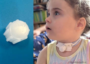 child with a tracheostomy cap and an inset showing a close up of a tracheostomy cap