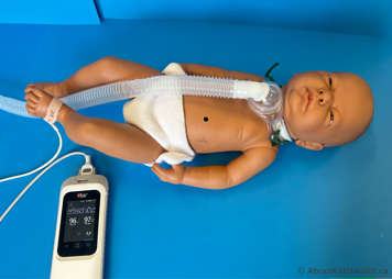 Baby with a tracheostomy lying comfortably on their back