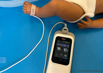 Oximeter attached to a child's foot showing accurate readings