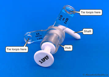 A tracheostomy tube showing the shaft, neck plate (flange), flange loop and hub (opening)