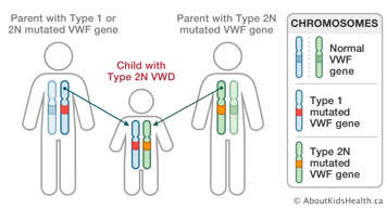 Chromosomes in parent with Type 1 or 2N mutated VWF gene, parent with Type 2N mutated VWF gene, and child with Type 2N VWD