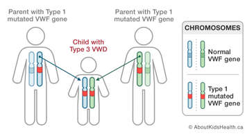 Chromosomes in parents who both have Type 1 mutated VWF gene and in child with Type 3 VWD